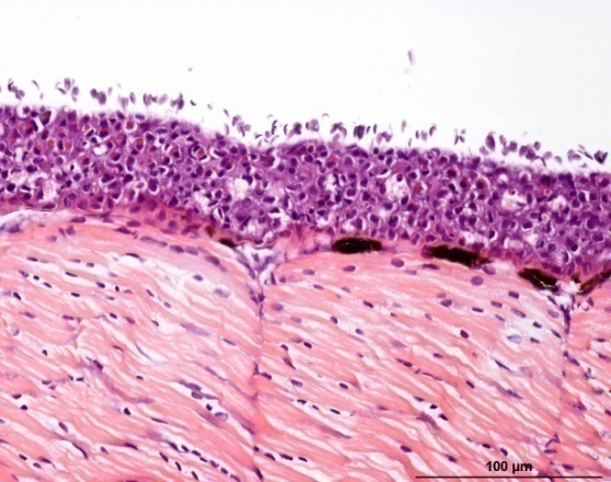 Penyakit Costiosis